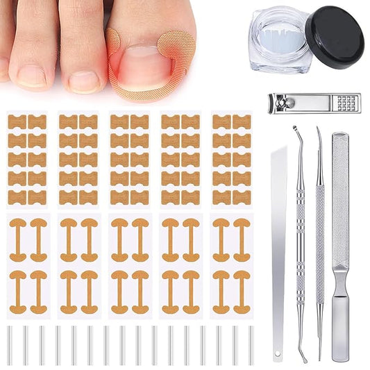 Hyggear Set de uñas encarnadas con parches transpirables para uñas encarnadas