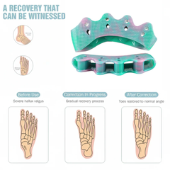 Corrector de juanetes (Hallux Valgus) para dedo gordo del pie HYGGEAR