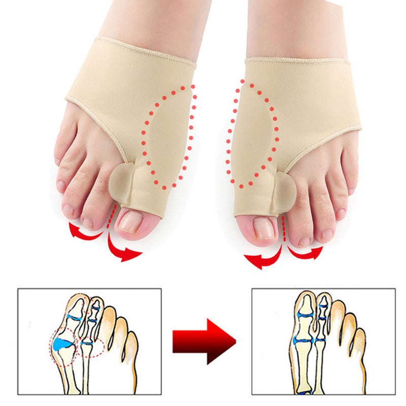 Oferta exclusiva para VIP: corrector de juanetes para el dedo gordo del pie Hyggear