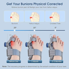 Hyggear Bunion Fix Pro - Corrector para Mujeres y Hombres: Corrector de Juanetes Ajustable para Aliviar el Dolor por Separación del Dedo Gordo, Férula Ortopédica para Juanetes con Enderezador para la Alineación de los Dedos