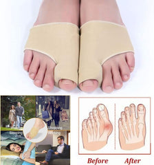 Oferta exclusiva para VIP: corrector de juanetes para el dedo gordo del pie Hyggear