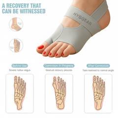 Corrector de juanetes (Hallux Valgus) para hombres y mujeres HYGGEAR